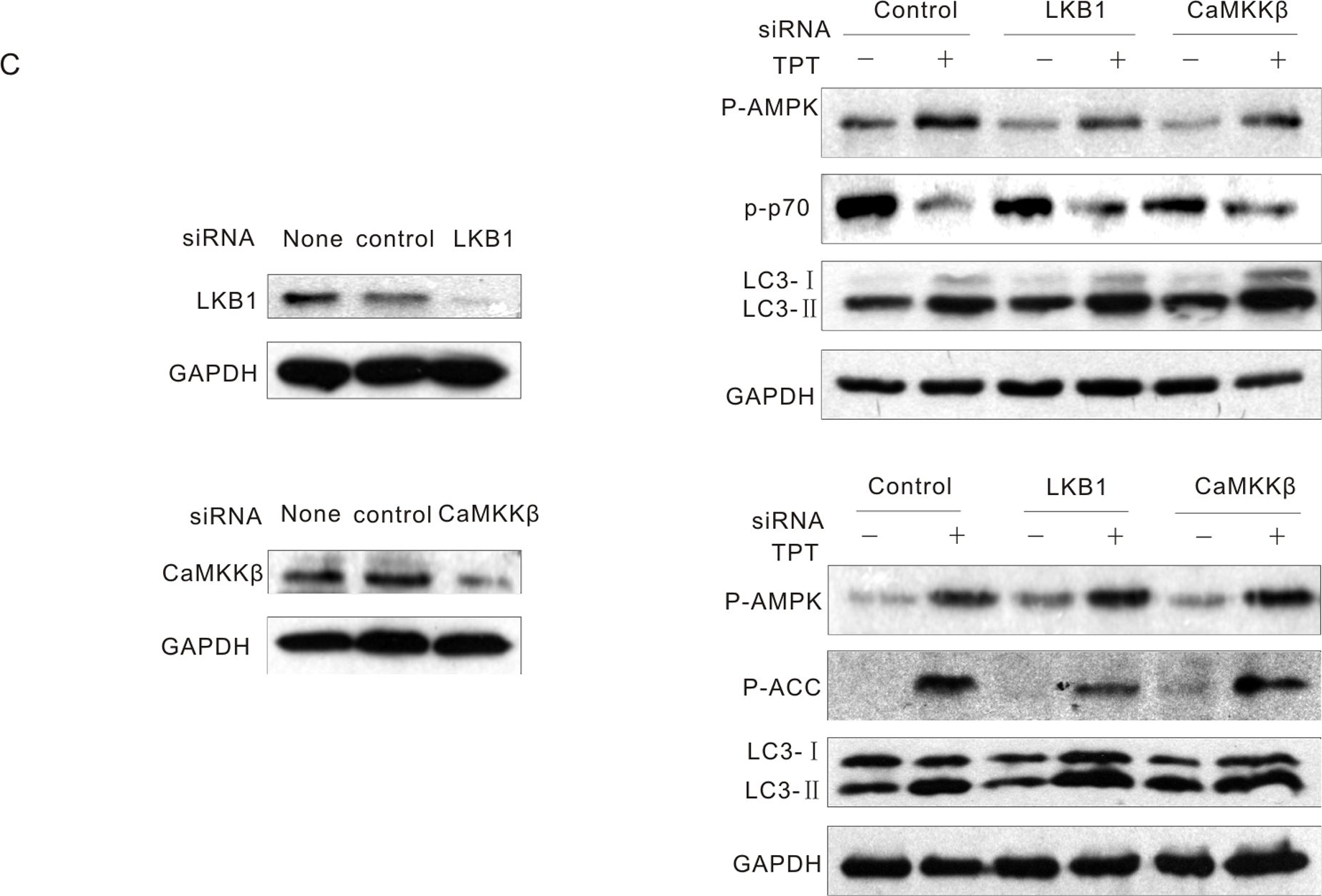 LC3B Antibody - BSA Free