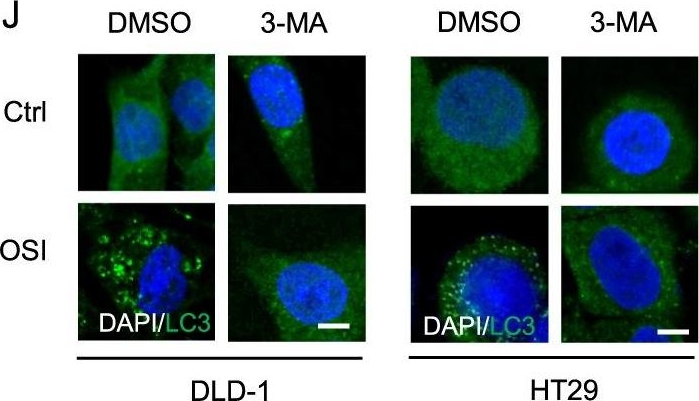 LC3B Antibody - BSA Free