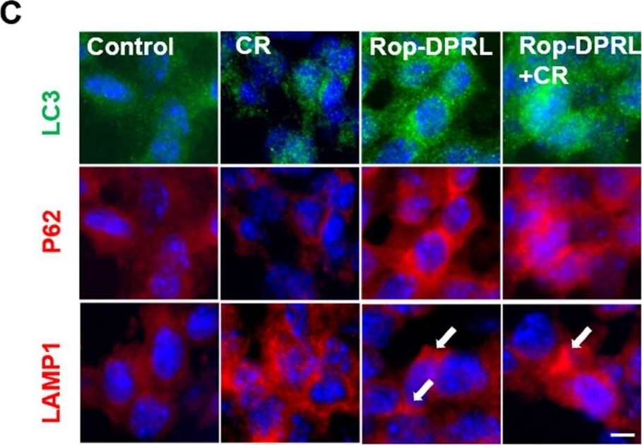 LC3B Antibody - BSA Free