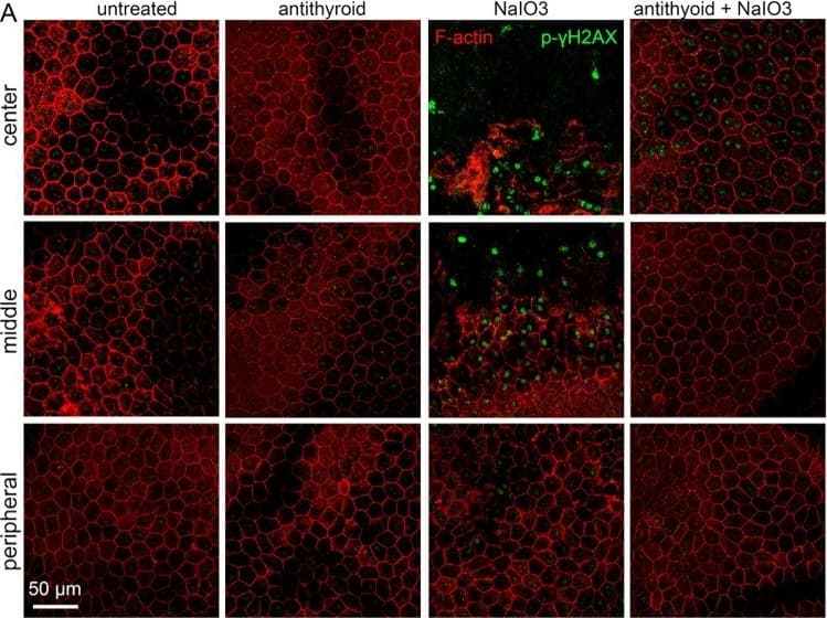 Histone H2AX [p Ser139] Antibody