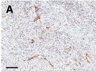 CD31/PECAM-1 Antibody