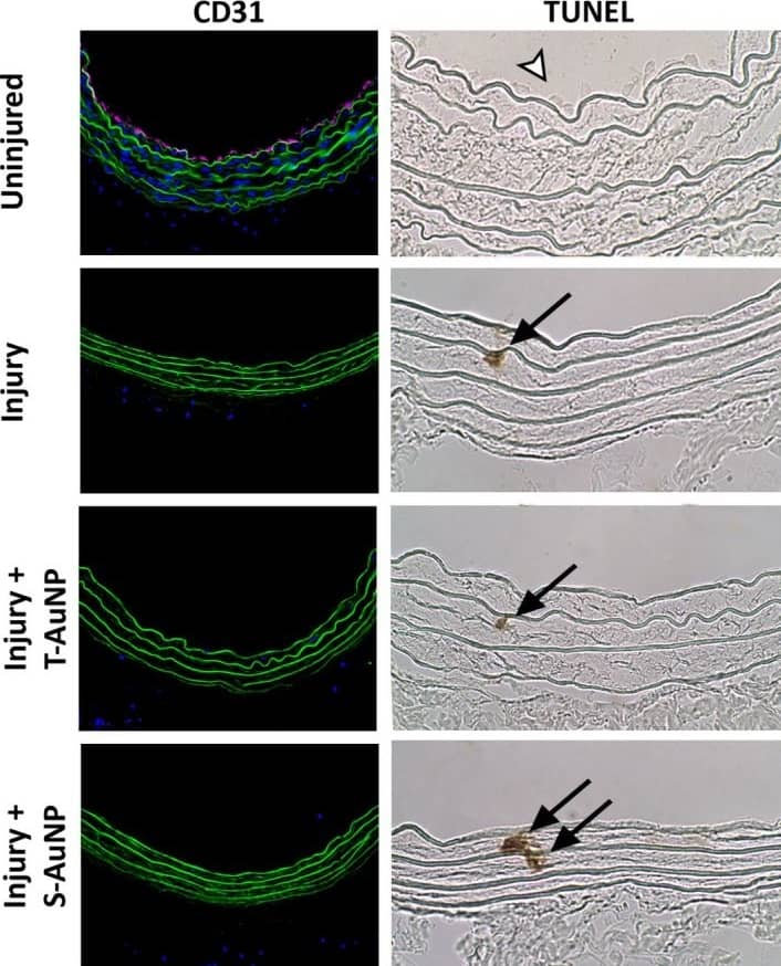 CD31/PECAM-1 Antibody