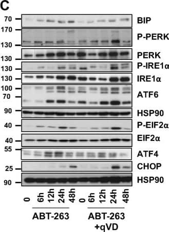 IRE1 alpha [p Ser724] Antibody - BSA Free