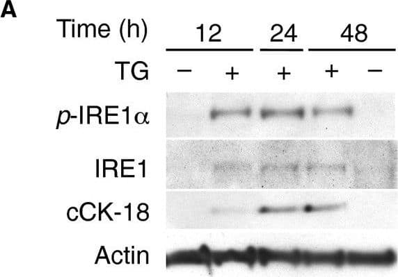 IRE1 alpha [p Ser724] Antibody - BSA Free