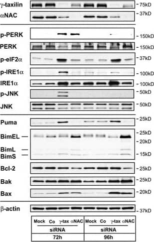 IRE1 alpha [p Ser724] Antibody - BSA Free