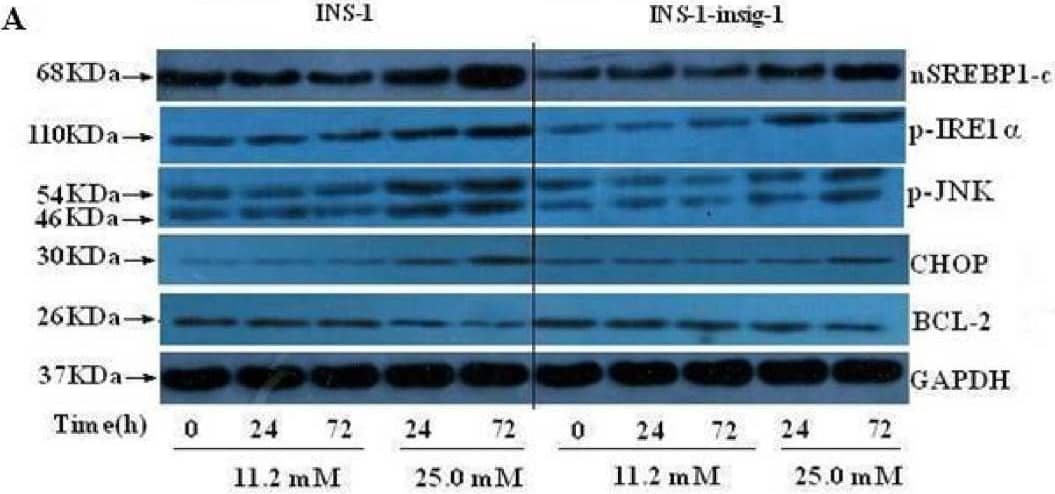 IRE1 alpha [p Ser724] Antibody - BSA Free
