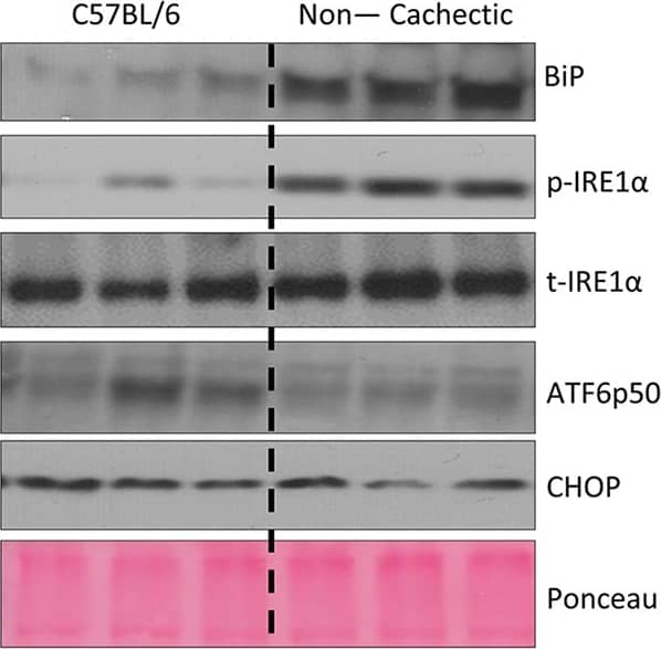 IRE1 alpha [p Ser724] Antibody - BSA Free