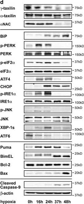 IRE1 alpha [p Ser724] Antibody - BSA Free (NB100-2323) by