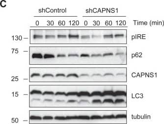 IRE1 alpha [p Ser724] Antibody - BSA Free