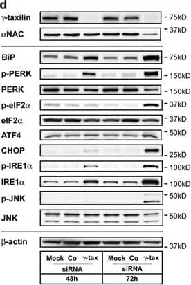 IRE1 alpha [p Ser724] Antibody - BSA Free