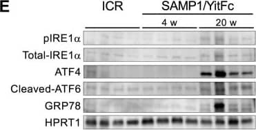 IRE1 alpha Antibody