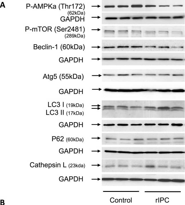 LC3A Antibody - BSA Free