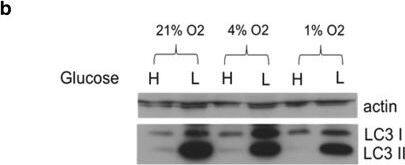 LC3A Antibody - BSA Free