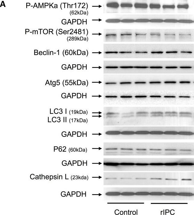 LC3A Antibody - BSA Free