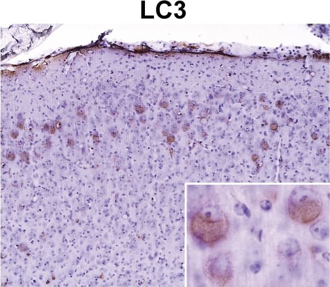 LC3A Antibody - BSA Free