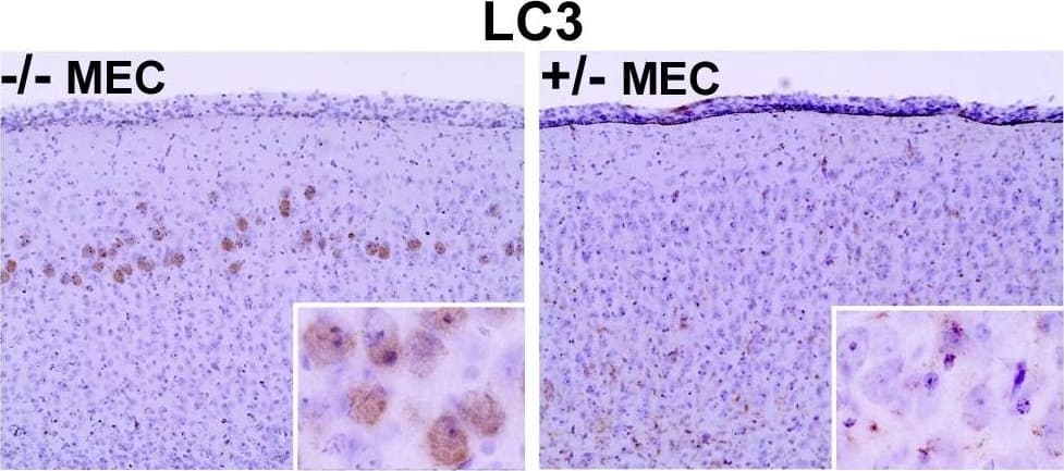 LC3A Antibody - BSA Free