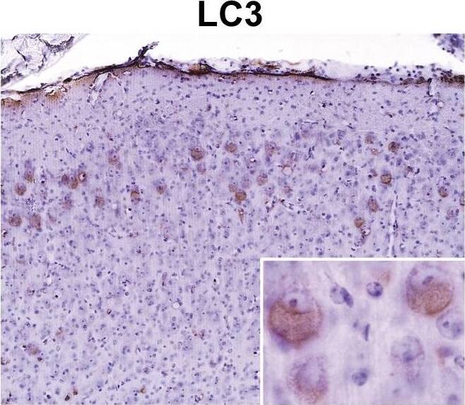 LC3A Antibody - BSA Free