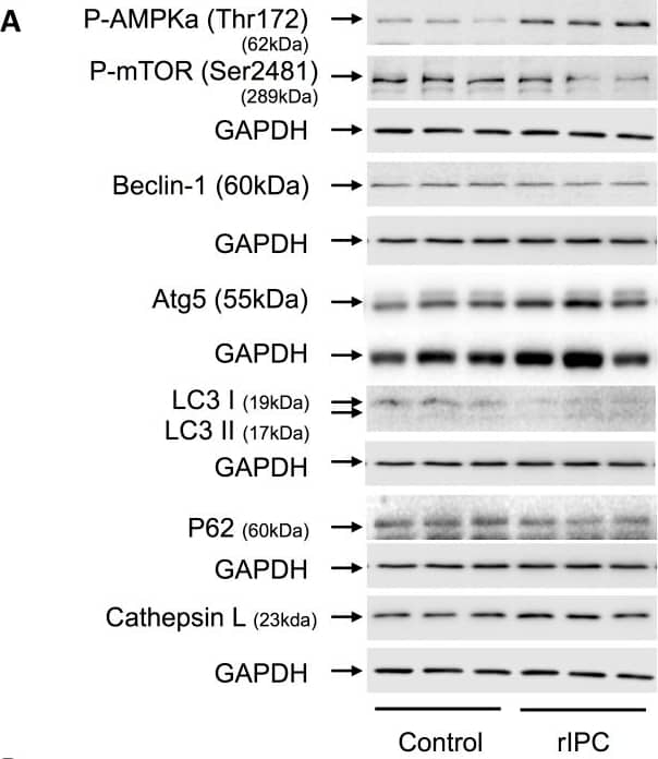 LC3A Antibody - BSA Free
