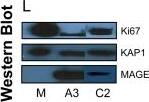 KAP1 [p Ser824] Antibody
