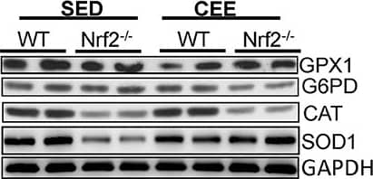 Glucose 6 Phosphate Dehydrogenase Antibody