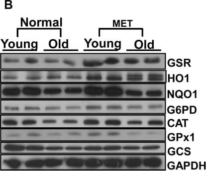 Glucose 6 Phosphate Dehydrogenase Antibody