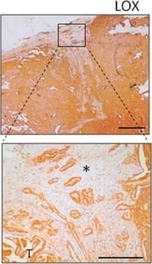 LOX Antibody - BSA Free