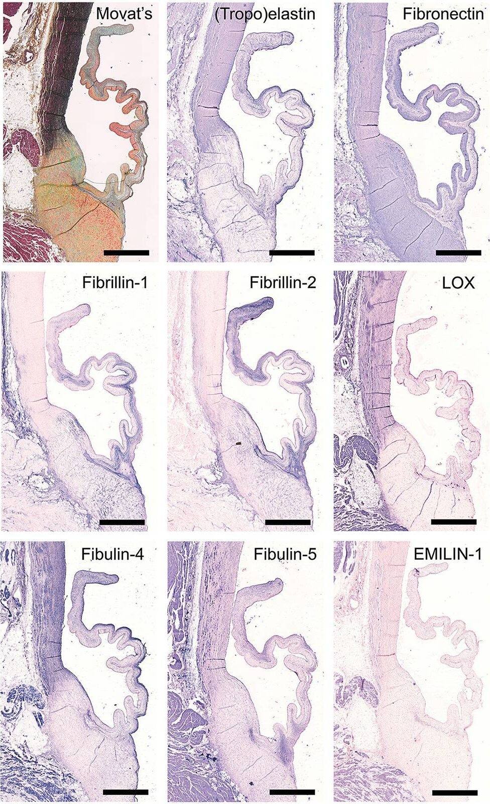 LOX Antibody - BSA Free