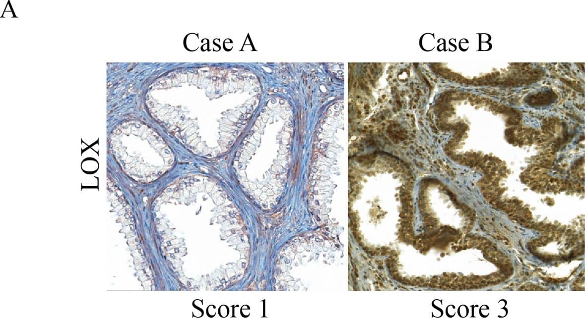 LOX Antibody - BSA Free