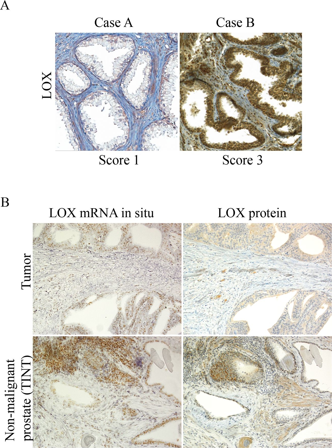 LOX Antibody - BSA Free