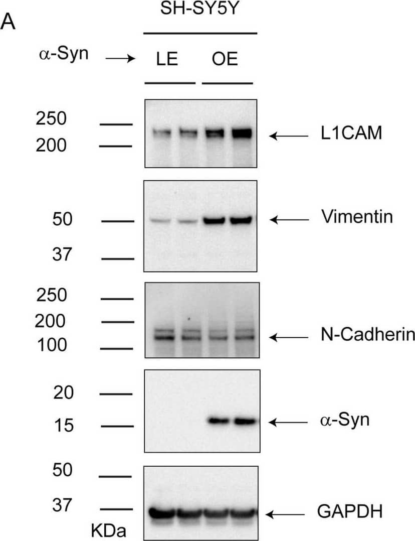 L1CAM Antibody (UJ127.11) - BSA Free