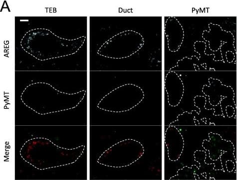 Polyoma Virus, Medium T Antigen Antibody (PyMT)