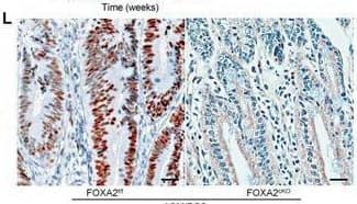HNF-3 beta/FoxA2 Antibody (OTI3C10)