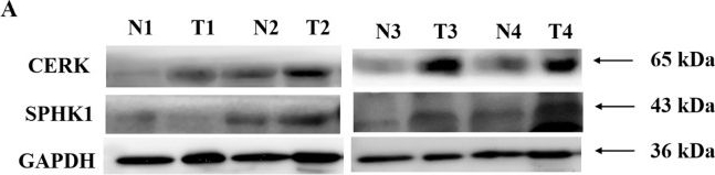Ceramide Kinase Antibody - BSA Free