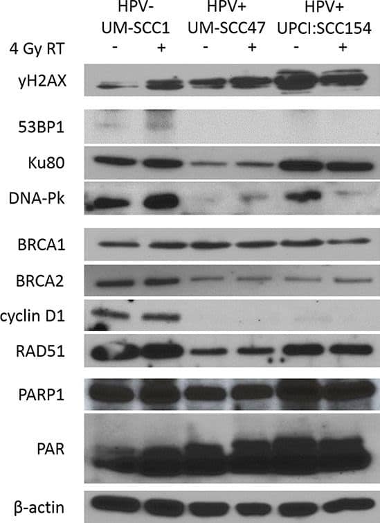 53BP1 Antibody - BSA Free