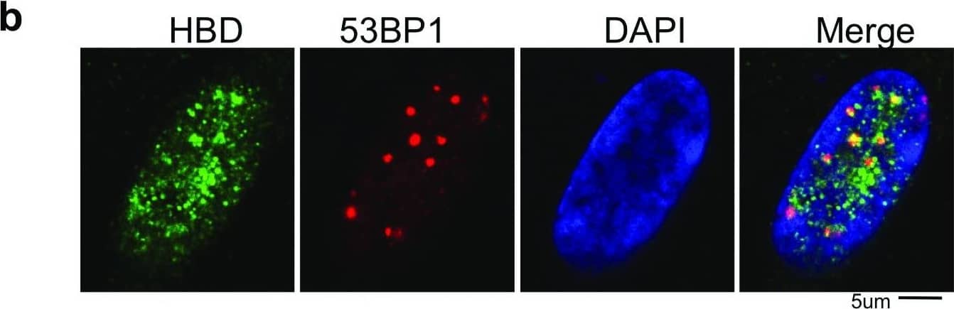 53BP1 Antibody - BSA Free (NB100-304) by Novus, Part of Bio 53BP1 Antibody - BSA Free (NB100-304) by Novus, Part of Bio