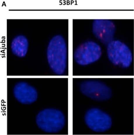 53BP1 Antibody - BSA Free