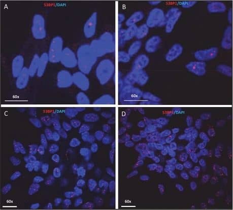 53BP1 Antibody - BSA Free