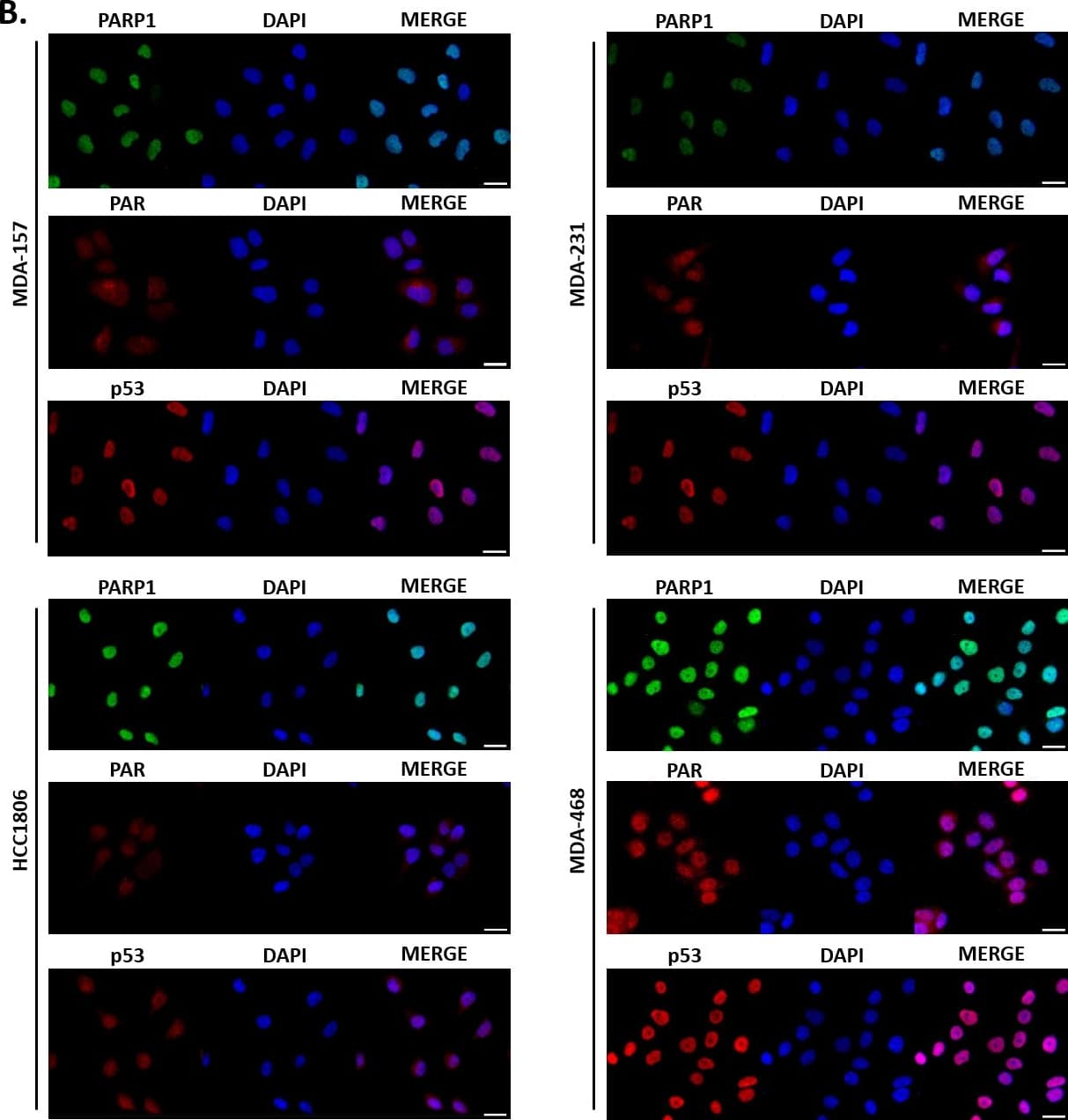 53BP1 Antibody - BSA Free