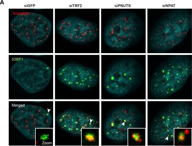 53BP1 Antibody - BSA Free