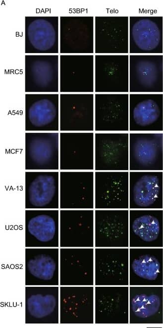 53BP1 Antibody - BSA Free