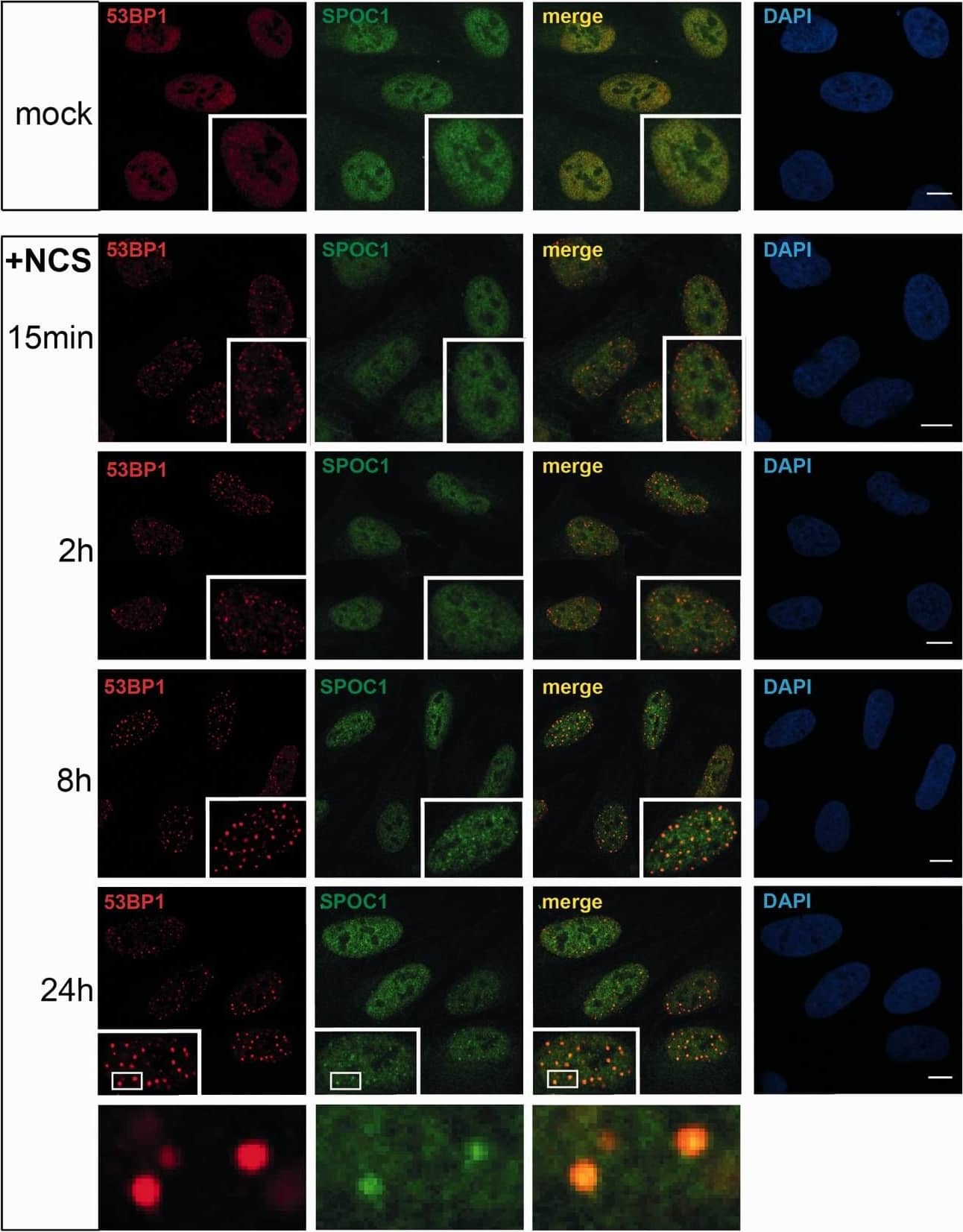 53BP1 Antibody - BSA Free