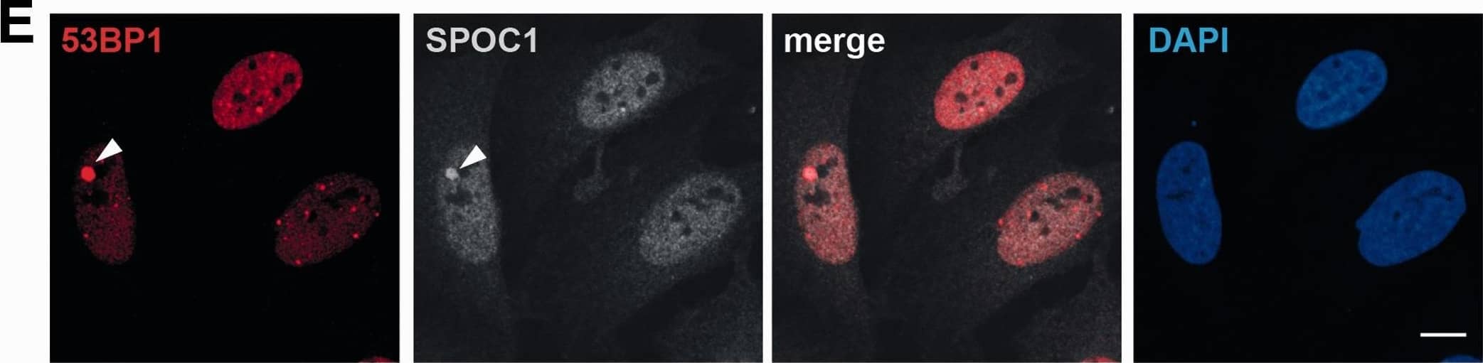 53BP1 Antibody - BSA Free