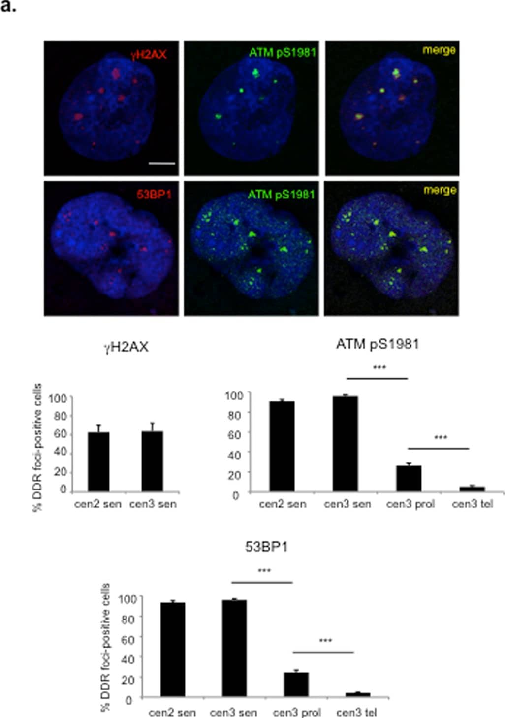 53BP1 Antibody - BSA Free