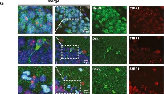 53BP1 Antibody - BSA Free