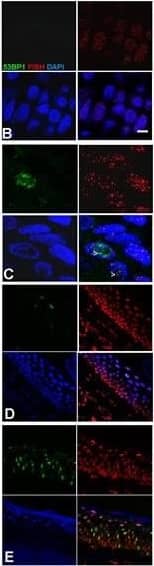 53BP1 Antibody - BSA Free