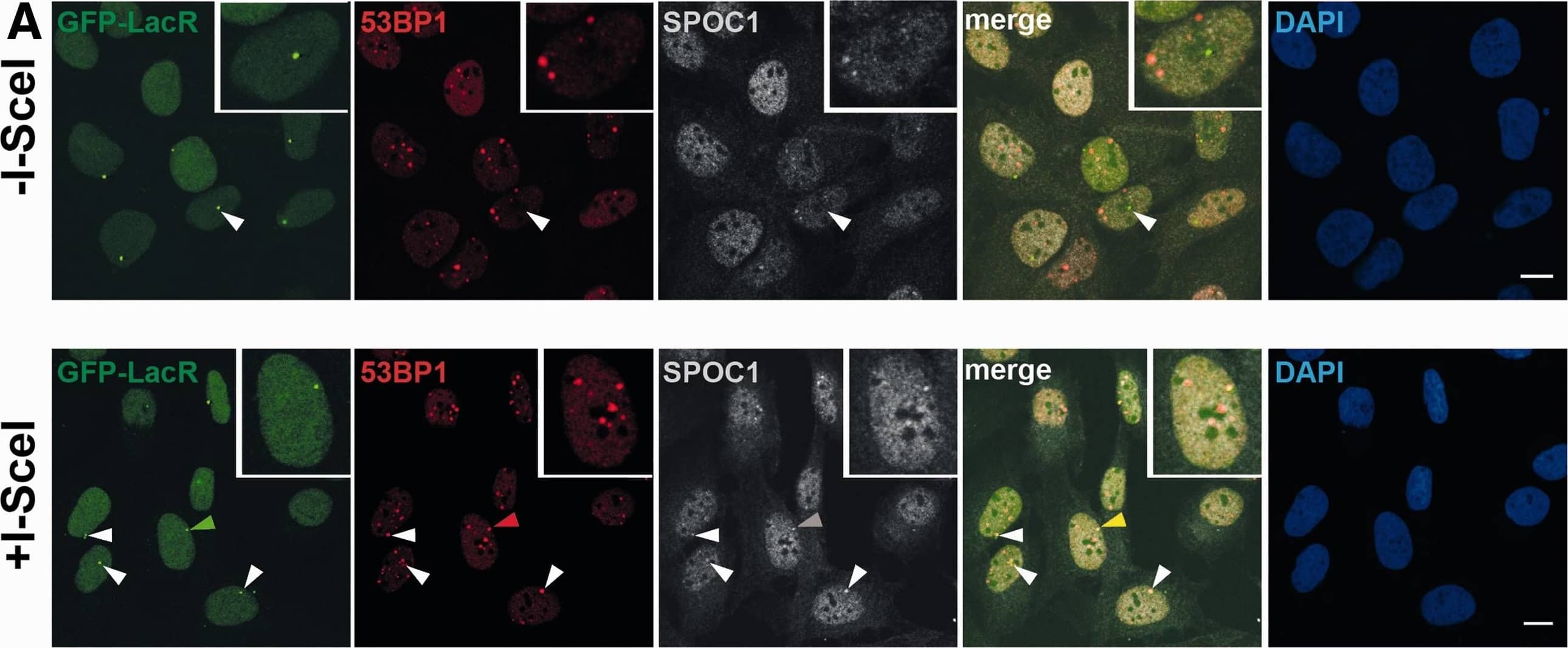 53BP1 Antibody - BSA Free
