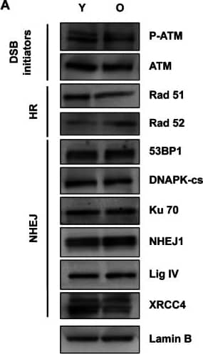 53BP1 Antibody - BSA Free