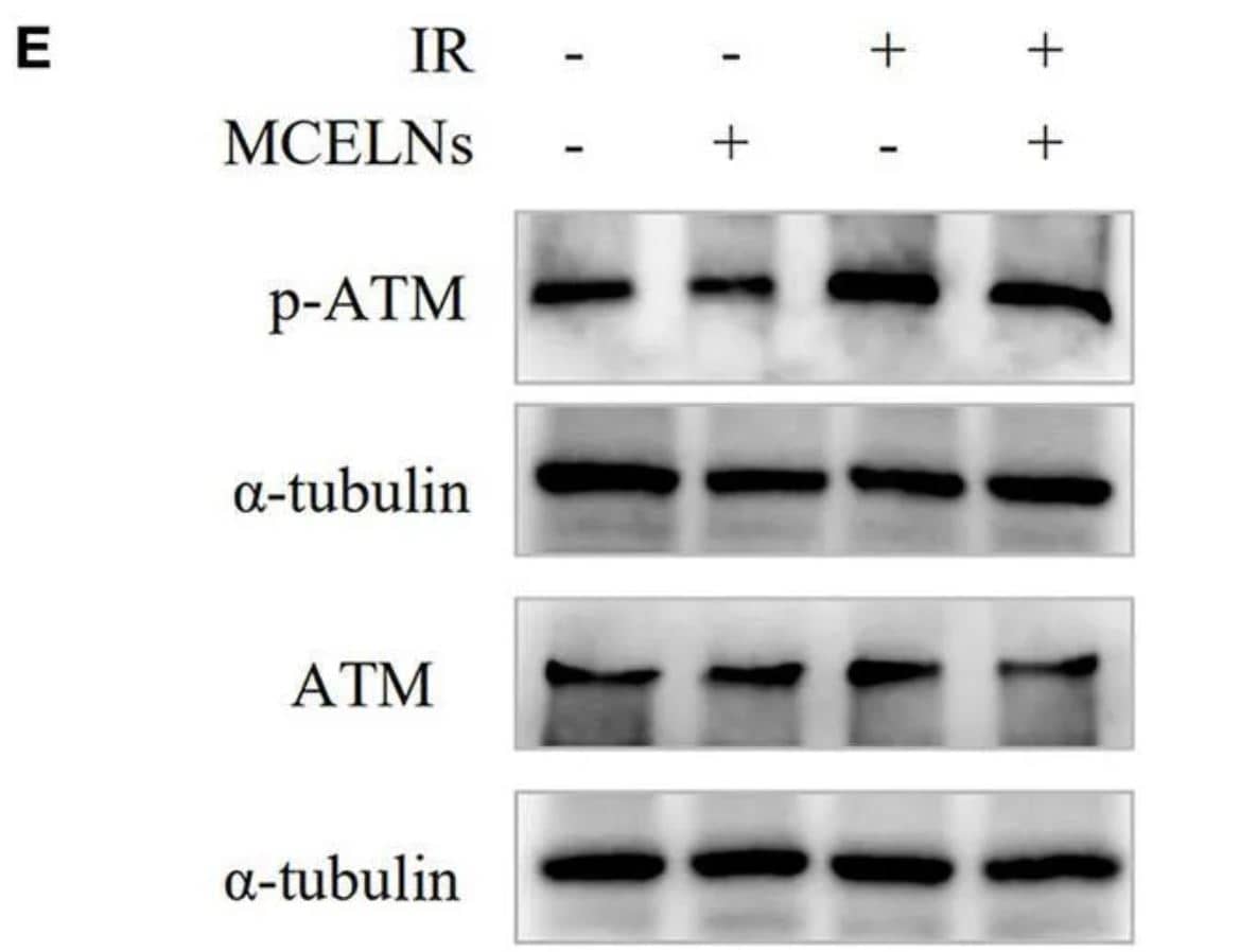 ATM [p Ser1981] Antibody (10H11.E12)