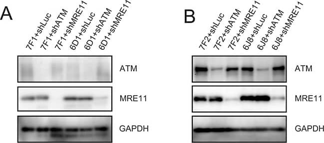 ATM Antibody (2C1)