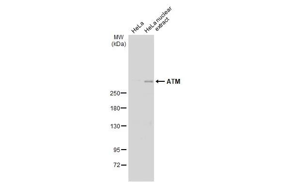 ATM Antibody (2C1)